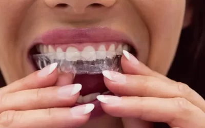 Invisalign St. Louis: Clear Aligner Therapy for Discreet Orthodontic Correction